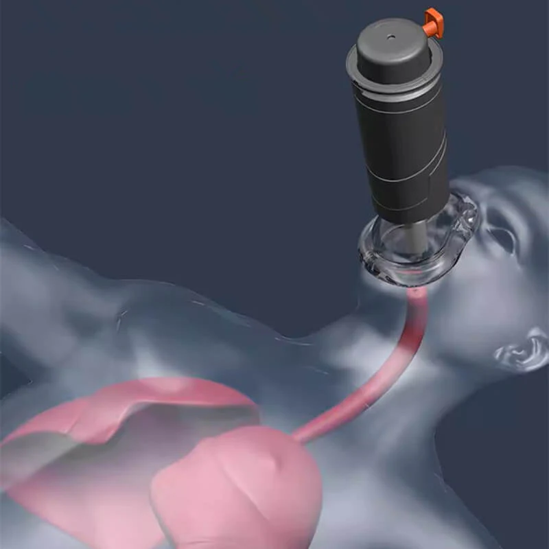 Negative pressure pharyngeal suction