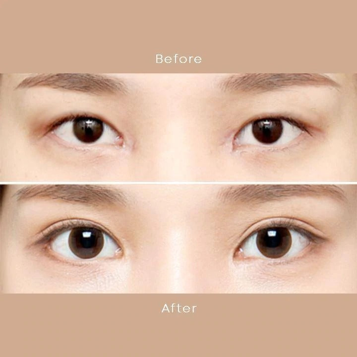 2022 Eyelid Lifting Strip