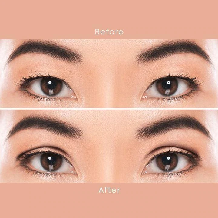 2022 Eyelid Lifting Strip