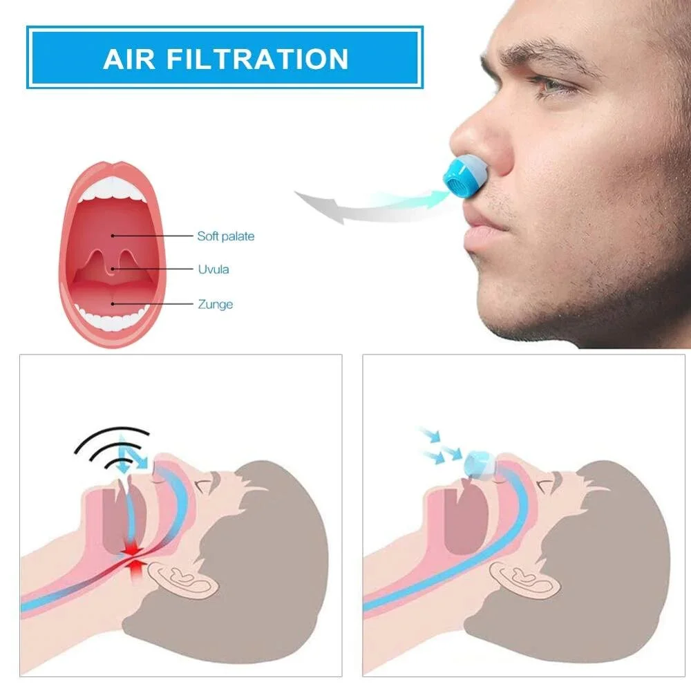 The First Hoseless, Maskless, Micro-CPAP