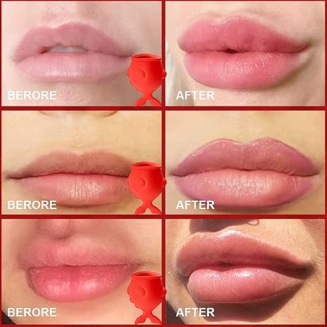 Lip Enhancement Fish Mouth Silicone Lip Enhancement Instrument