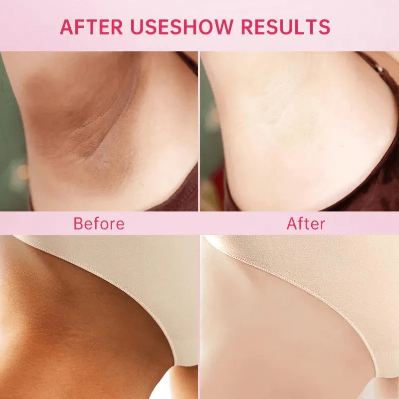 Bleaching Whitening Cream