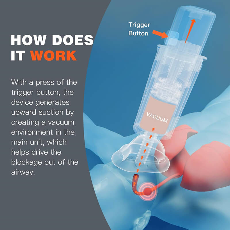 Negative pressure pharyngeal suction