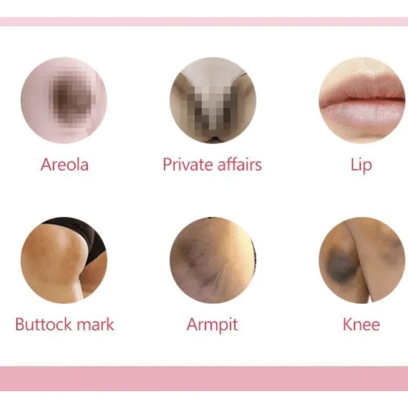 Bleaching Whitening Cream