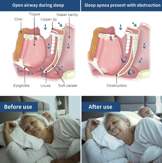 120PCS Mouth Tape for Sleeping Gentle Sleep Strips Anti Snoring Devices