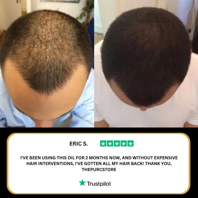 Natural Hair Growth Oil